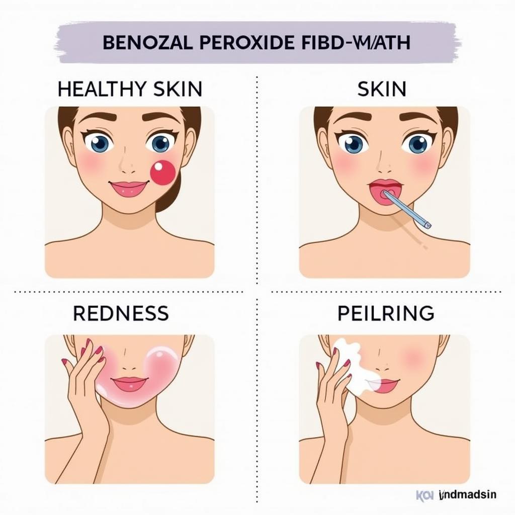 Benzoyl Peroxide Face Wash Side Effects