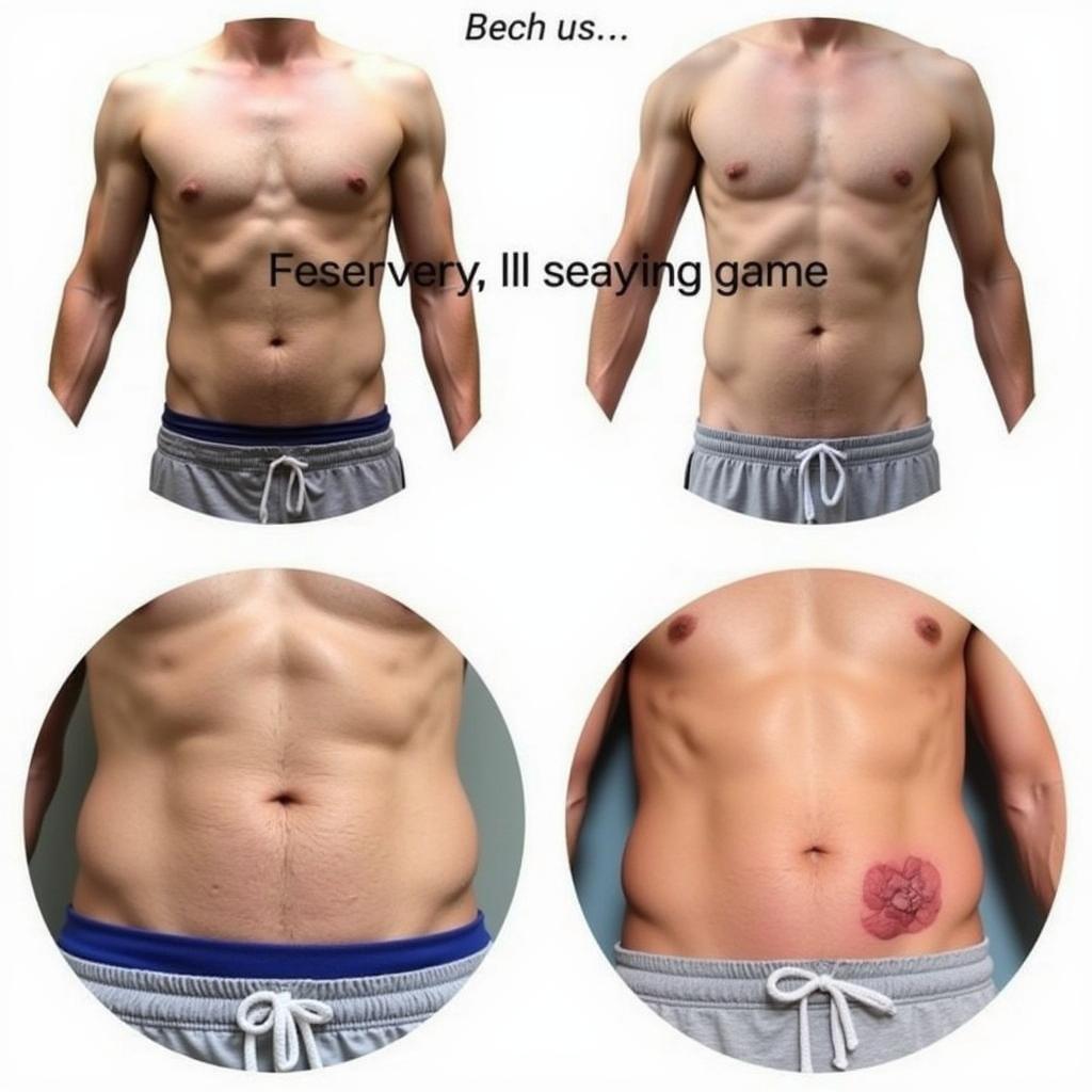 Gynecomastia Surgery Recovery