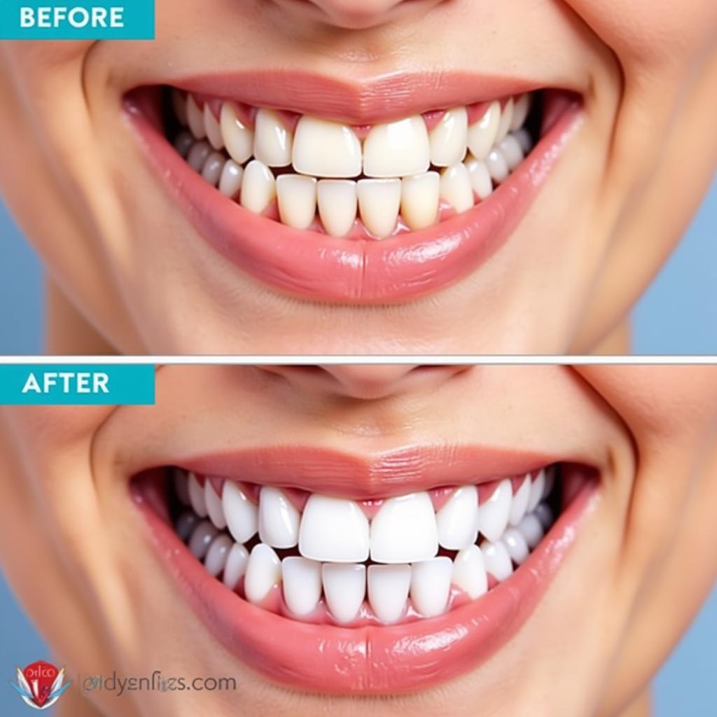 Teeth Whitening Before and After